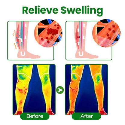 VeinFlex Magnesium Spray – Varicose Vein & Leg Pain Relief (FDA Certified)