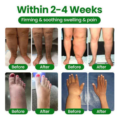 VeinFlex Magnesium Spray – Varicose Vein & Leg Pain Relief (FDA Certified)