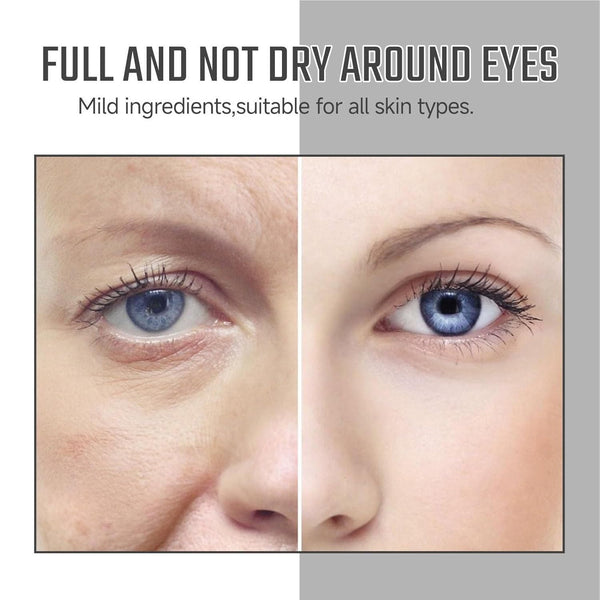 Luteglow Anti-Wrinkle Serum (BUY 1 GET 1 FREE)