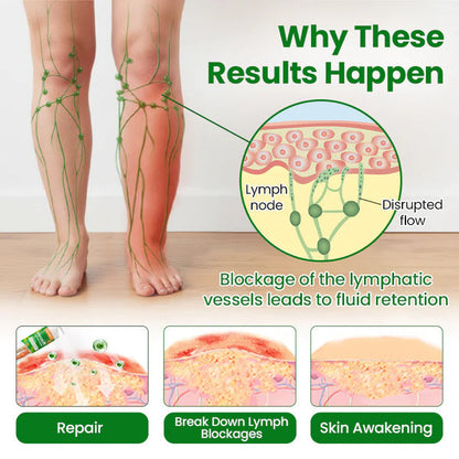 VeinFlex Magnesium Spray – Varicose Vein & Leg Pain Relief (FDA Certified)