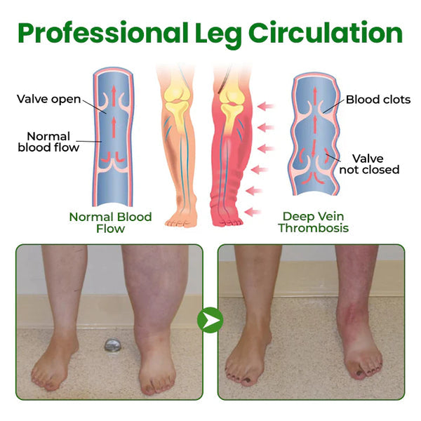 VeinFlex Magnesium Spray – Varicose Vein & Leg Pain Relief (FDA Certified)