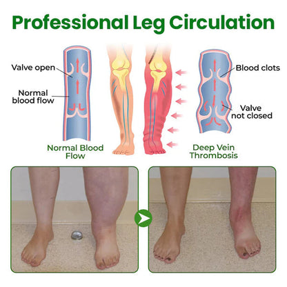 VeinFlex Magnesium Spray – Varicose Vein & Leg Pain Relief (FDA Certified)