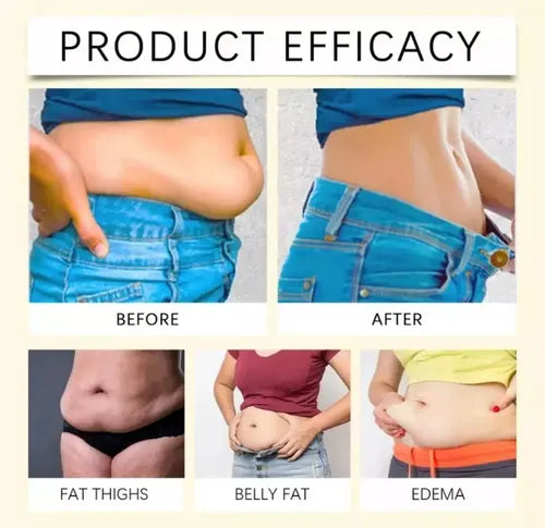 South Moon Bee Venom Slimming Patch – Lymphatic Detox Patches (Buy 10 Get 10)