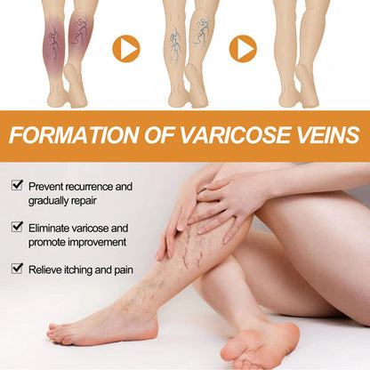 Varicose Vein Relief Spray – Natural Leg Pain & Swelling Relief