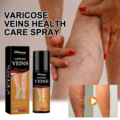 Varicose Vein Relief Spray – Natural Leg Pain & Swelling Relief