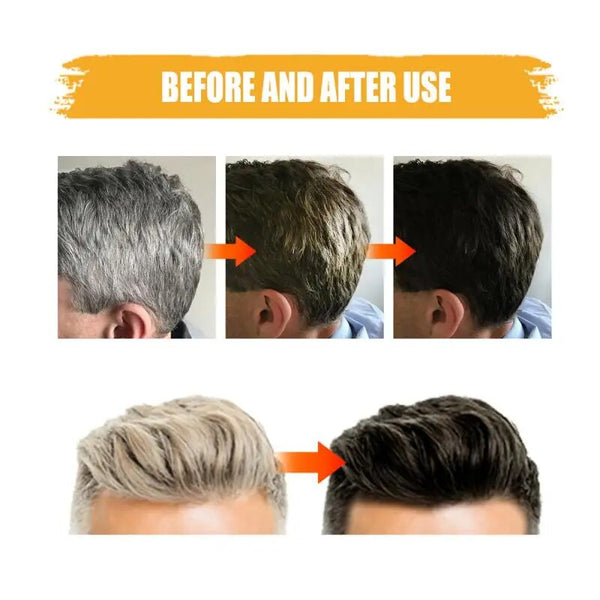 East Moon Black Soap Shampoo Bar (Pack of 2) – Herbal Hair Cleanser