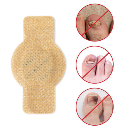 NailHeal Fungal Nail Patches – Anti-Fungal Treatment Strips