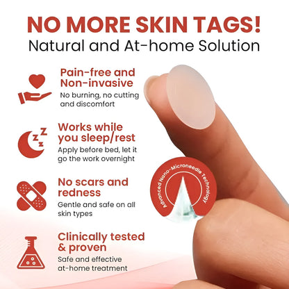 DermaSmooth Skin Tag & Acne Removal Patches – Fast Skin Treatment