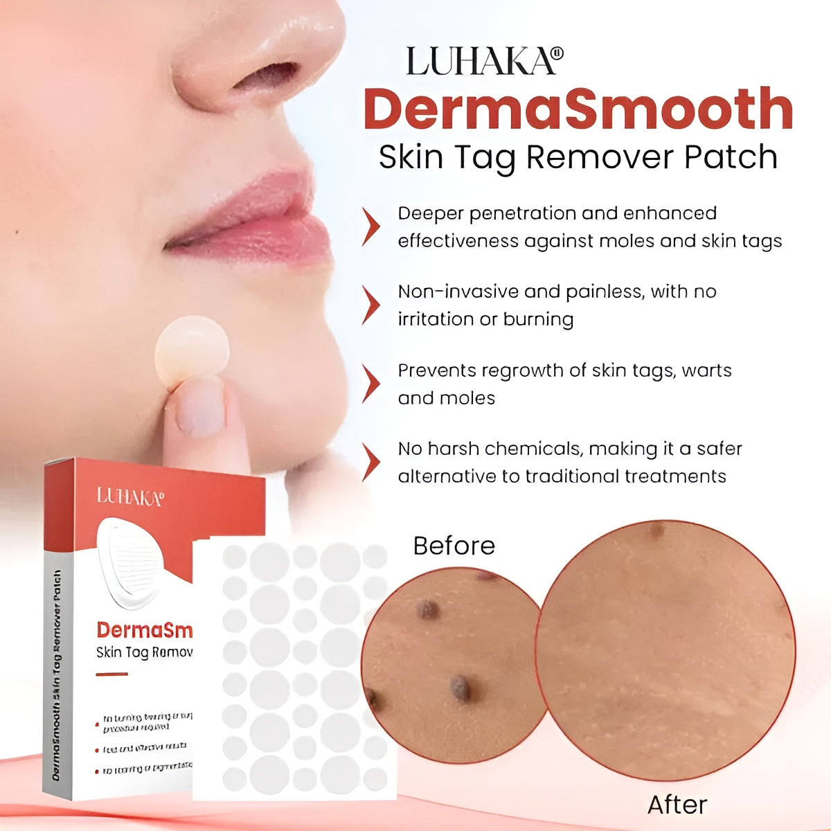 DermaSmooth Skin Tag & Acne Removal Patches – Fast Skin Treatment